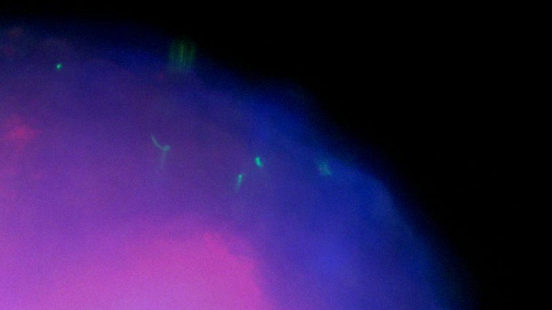 Borrelia is a threat to the human brain