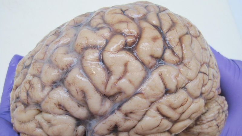Genetic engineers enter the human brain
